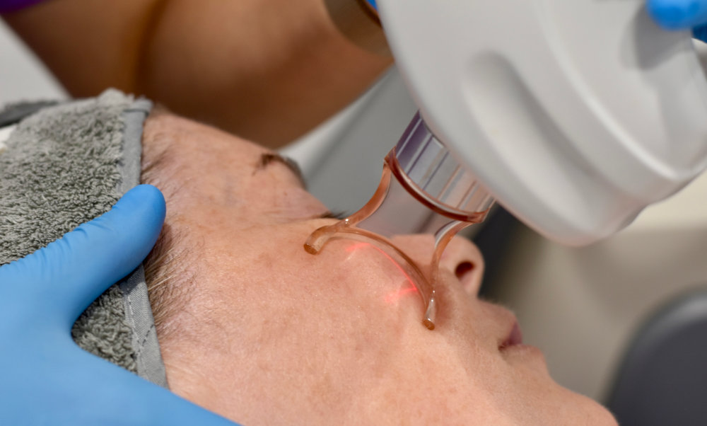 Surgical CO2 Laser Treatment