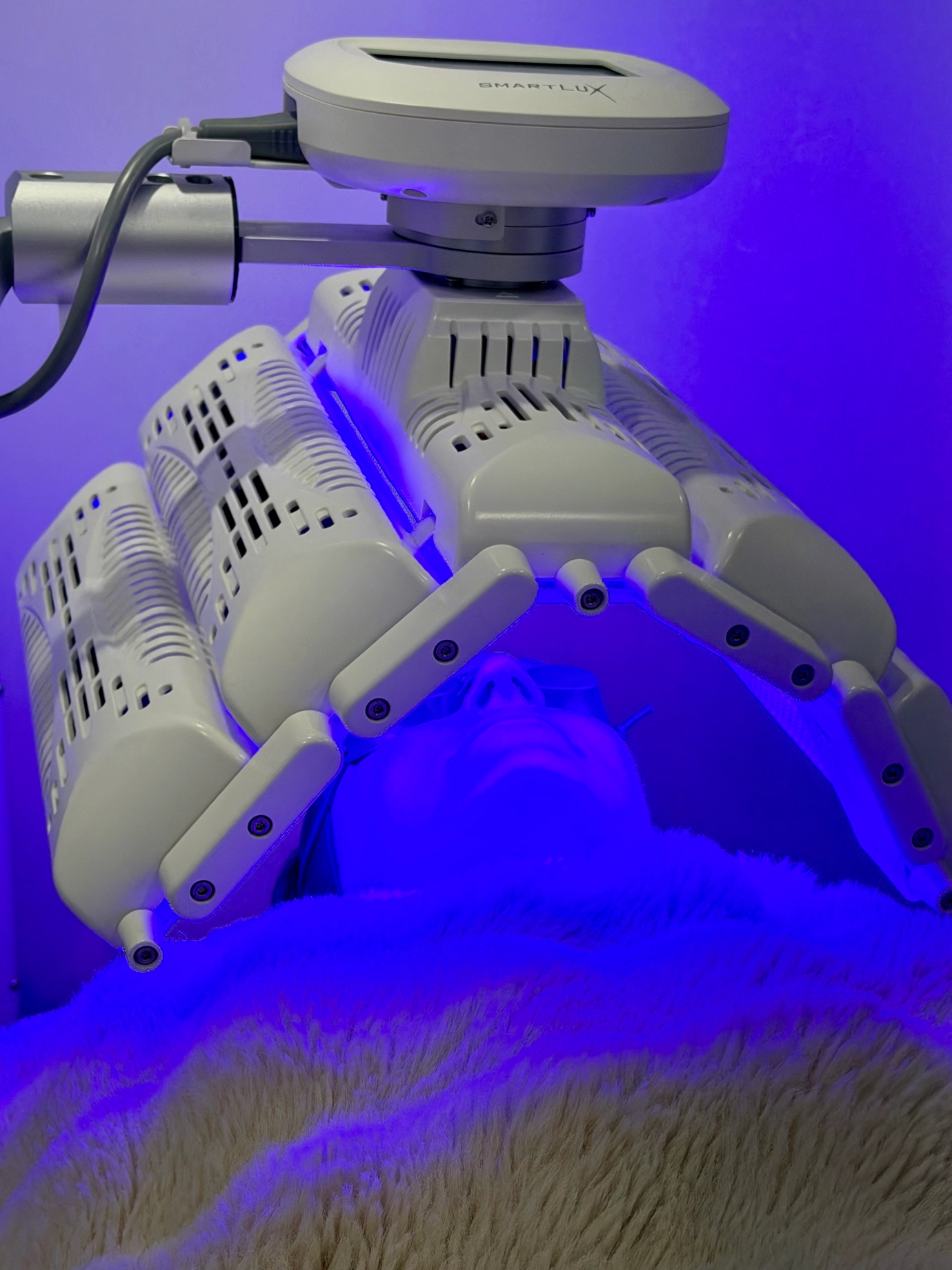 Blue Light Led Therapy for Acne Management